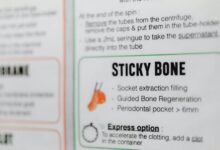 audience engine 2524291726 optimization guide