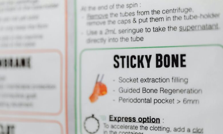 audience engine 2524291726 optimization guide